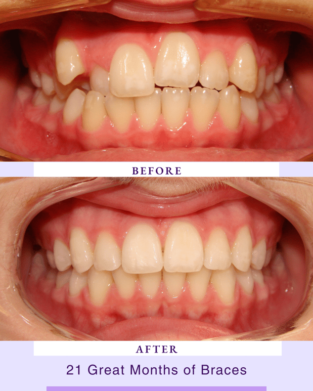 Images Above & Beyond Orthodontics