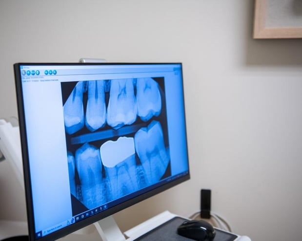 Images Sleep Dentistry of Vancouver West