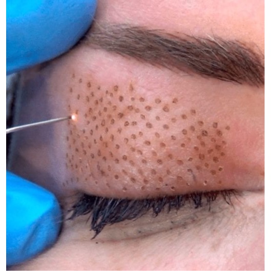 Images Permanent Makeup & Aesthetics in Maine