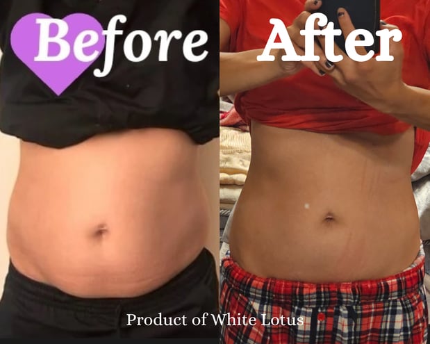 Images White Lotus Health and IV Wellness