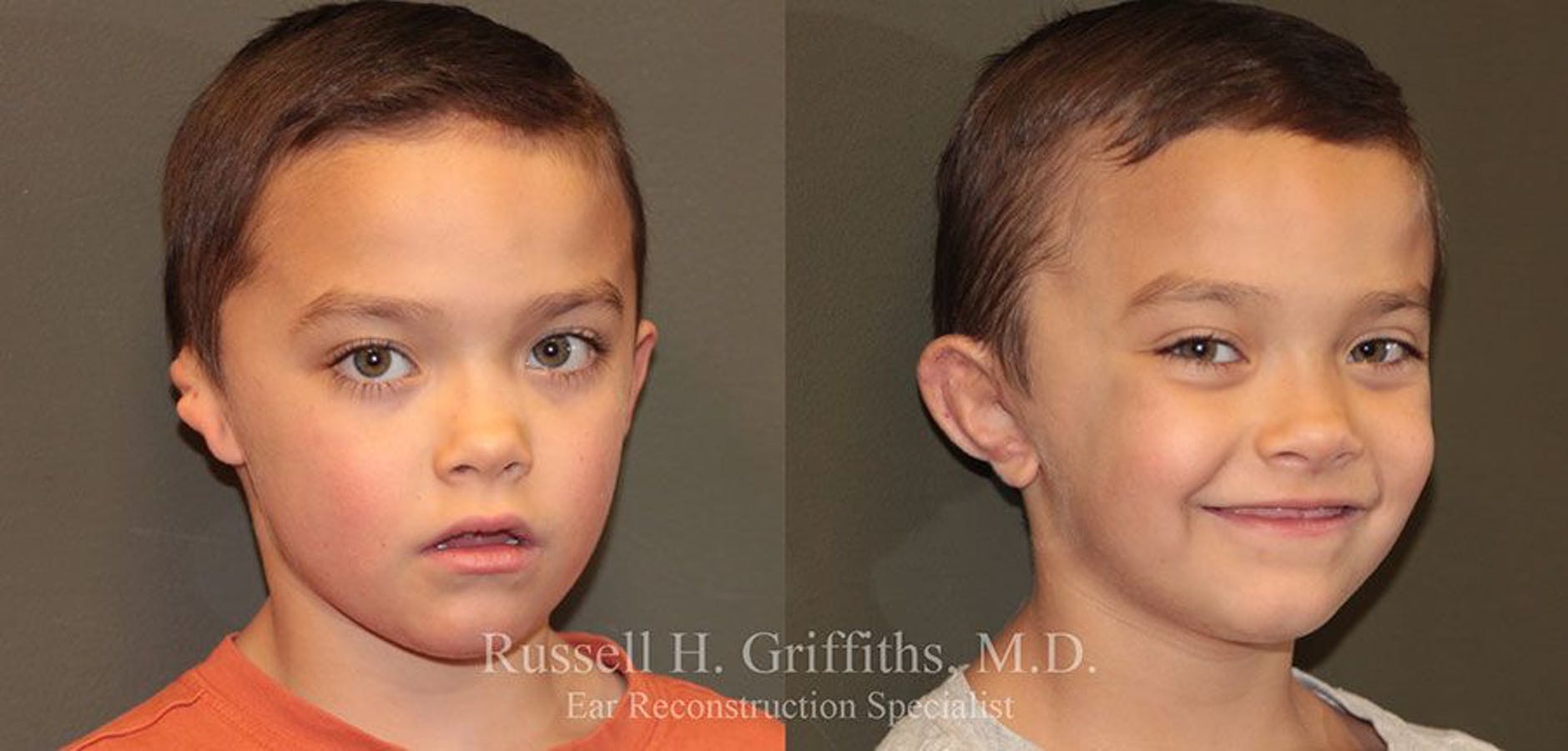 Results of Russell H. Griffiths, MD | Boise, ID