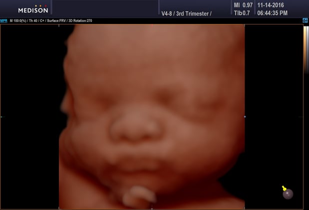 Images Heavenly 3D 4D Ultrasounds