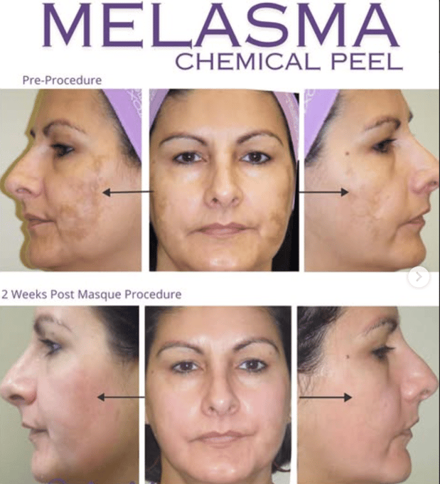 Images Semira Bayati, MD, FACS