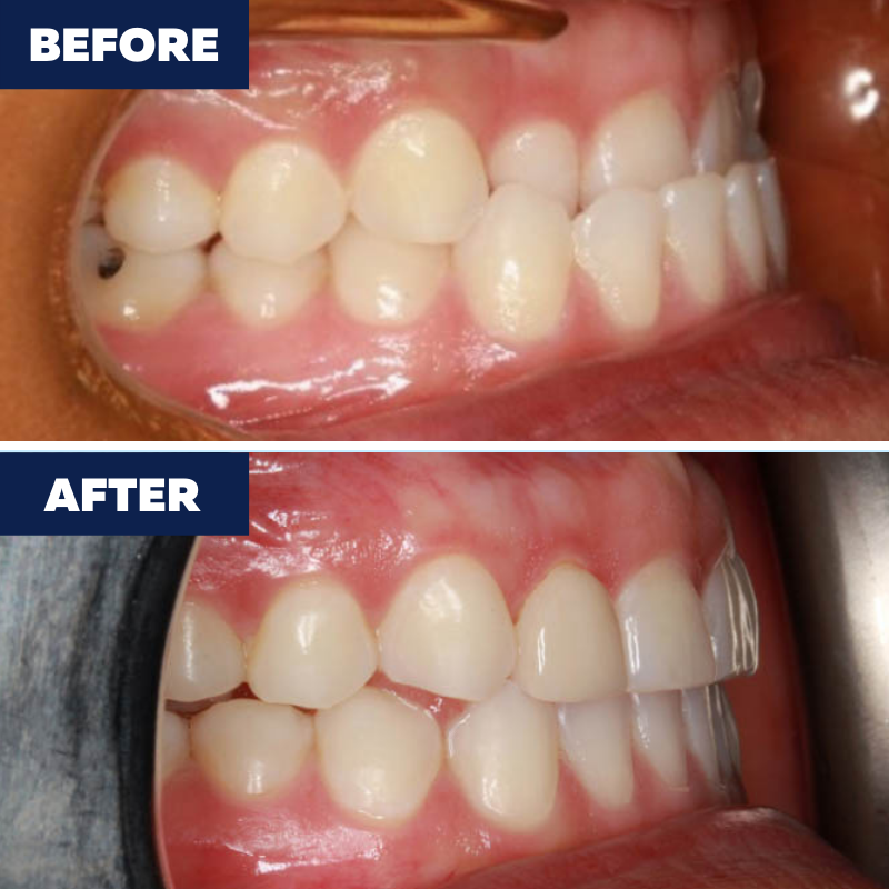 Images Orthodontist of Cerritos