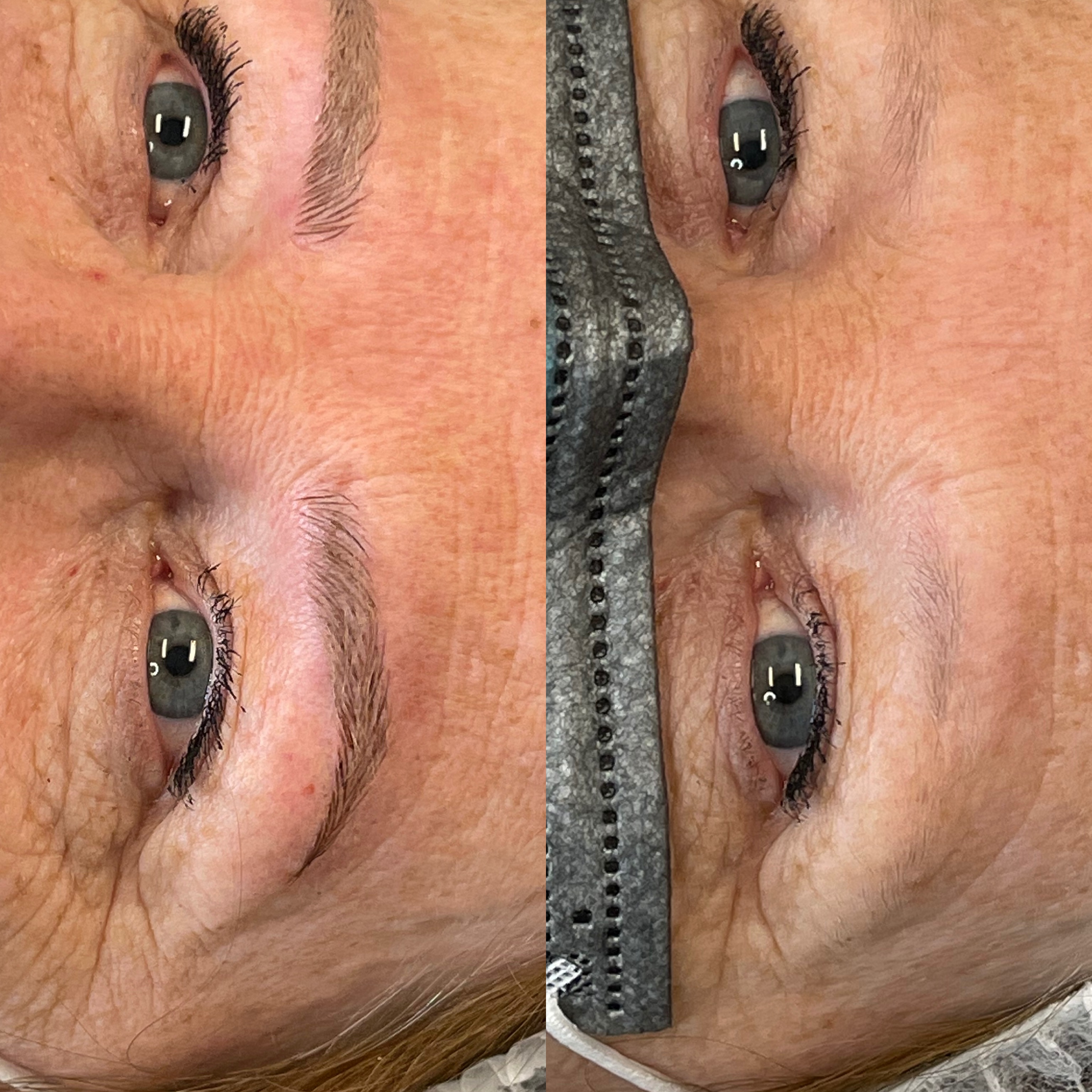 Images Clinique d'Esthétique Leila - Hydrafacial, Microblading, Épilation Laser Sainte-Foy