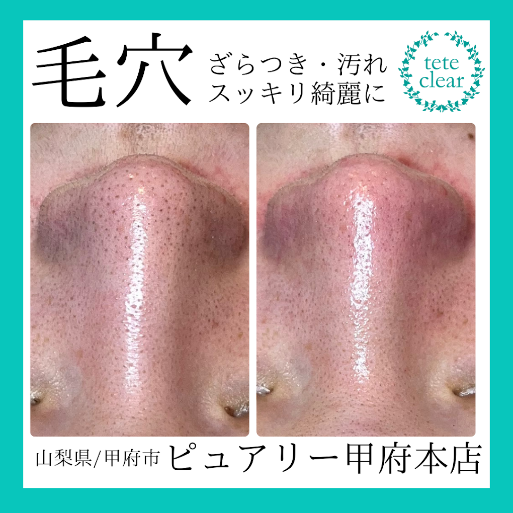 Images ピュアリーナチュラルライフスパ甲府本店