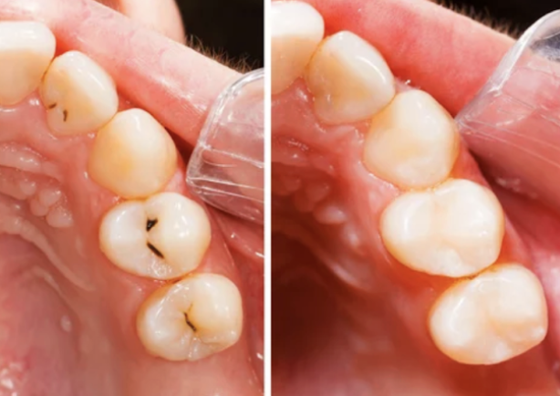 Images Emergency Dental of Dayton