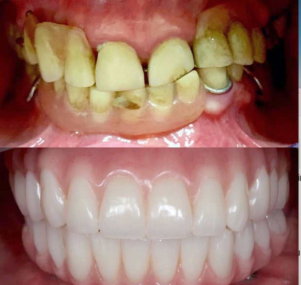 Images SouthPointe Dental