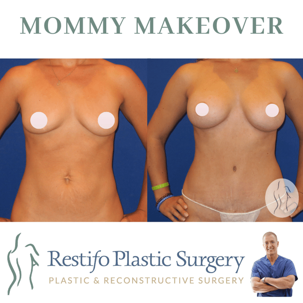 Images Restifo Plastic Surgery