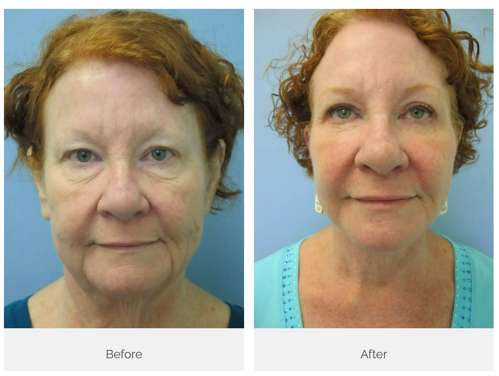 Castellano Cosmetic Surgery Center Image