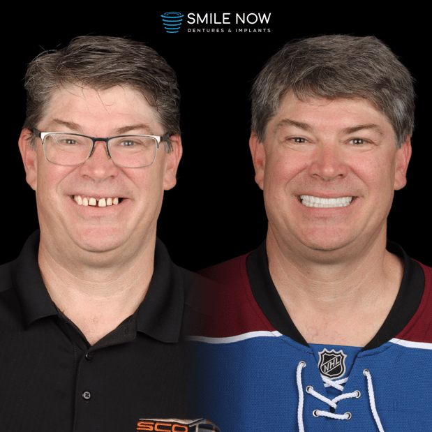 Images Smile Now Milwaukee Dentures and Implants