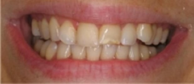 Images Glenlake Dental Care