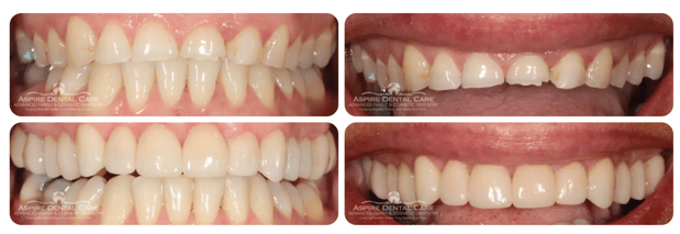 Images Aspire Dental Care PLLC