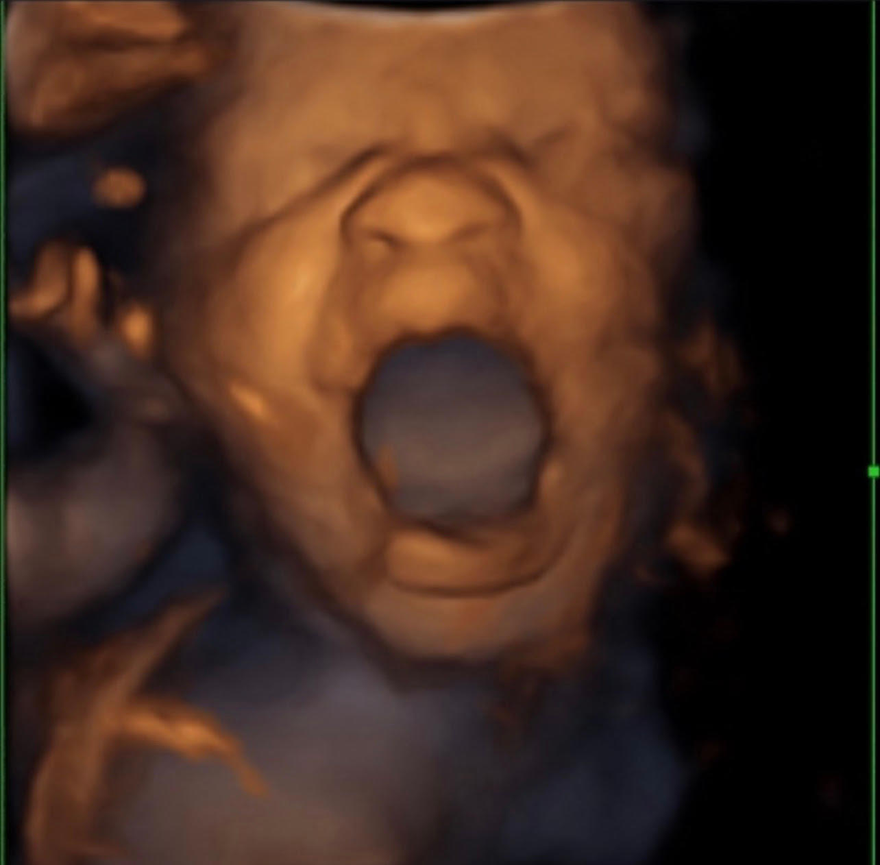 Image 8 | Belly 2 Birth 3D 4D Ultrasound