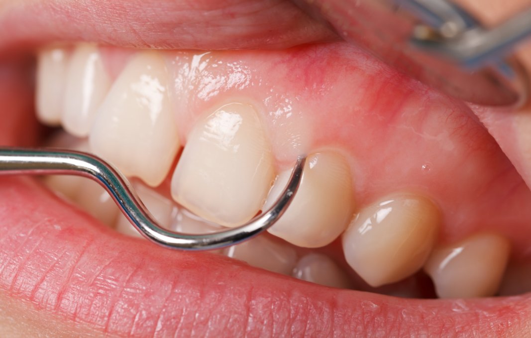 Images Clinique Dentaire Dr. Karam - Dentiste, Blanchiment Dentaire Ahuntsic
