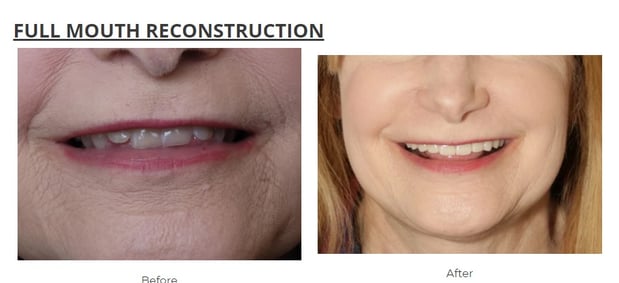Images Aspen Ridge Dental