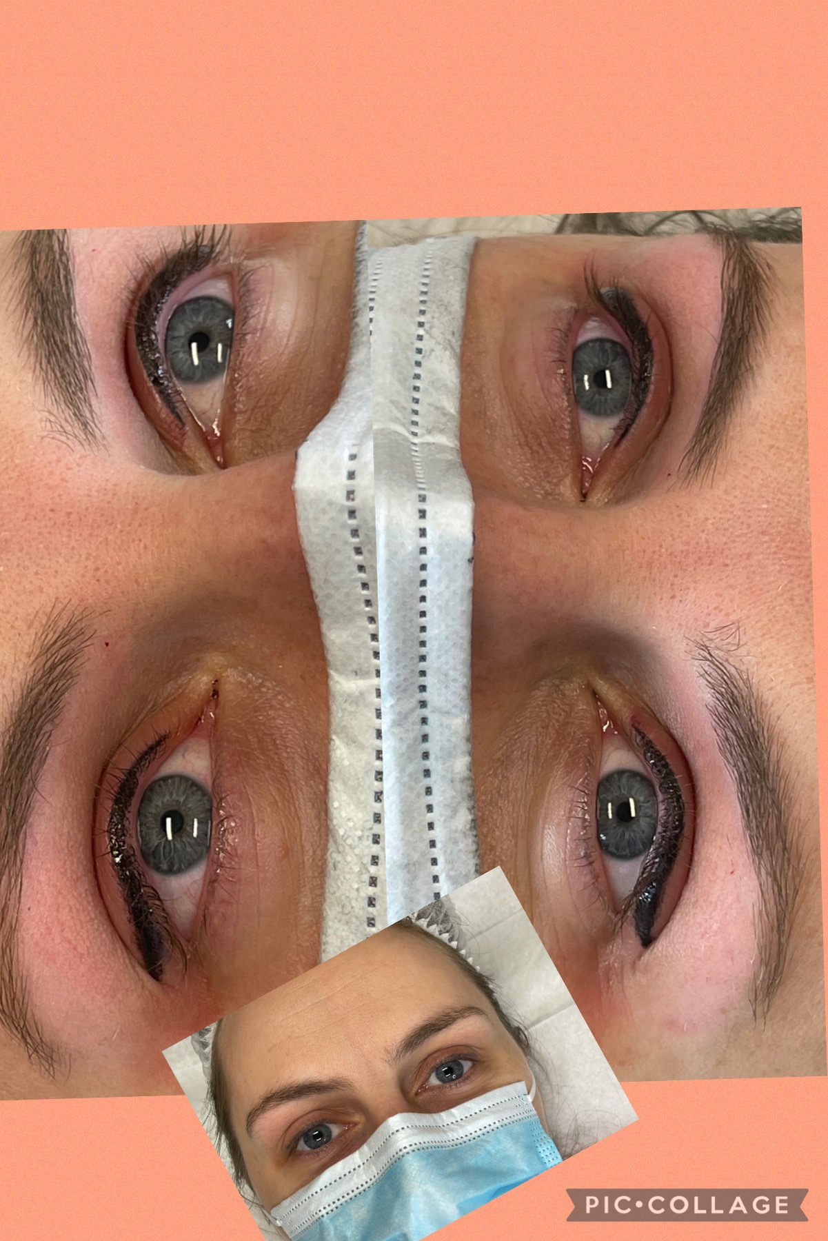 Images Clinique d'Esthétique Leila - Hydrafacial, Microblading, Épilation Laser Sainte-Foy