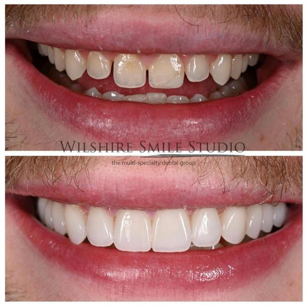 Images Wilshire Smile Studio