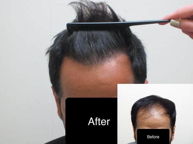 Images AZ Hair Restoration