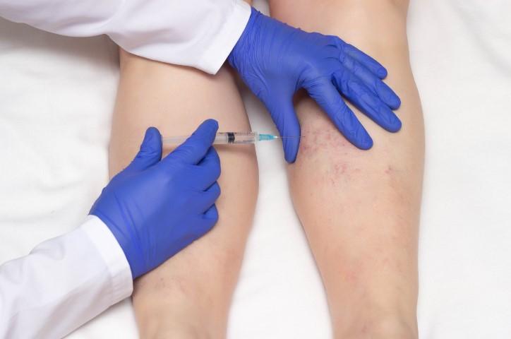 Images The Vein Institute Sydney - Varicose Vein Specialists
