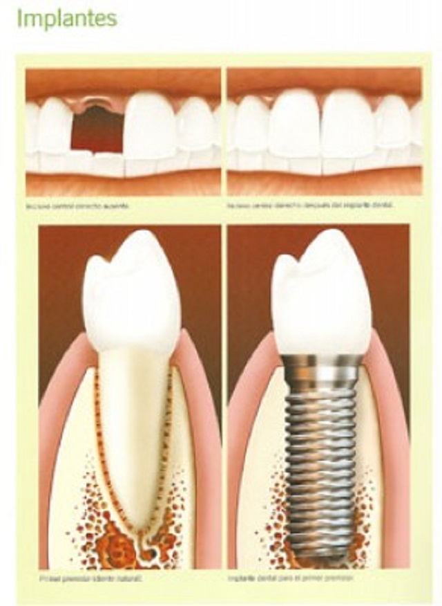 Images Clínica Dental Dr. Bordes Lleida