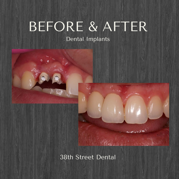 Images 38th Street Dental