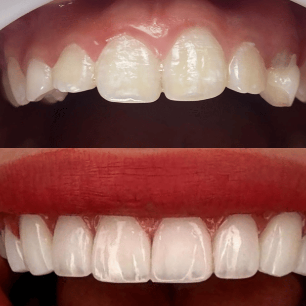 Images Selfie Smiles Dental Group