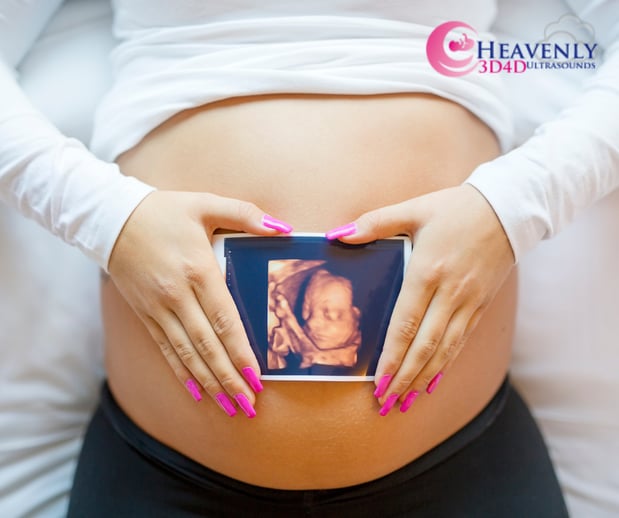 Images Heavenly 3D 4D Ultrasounds