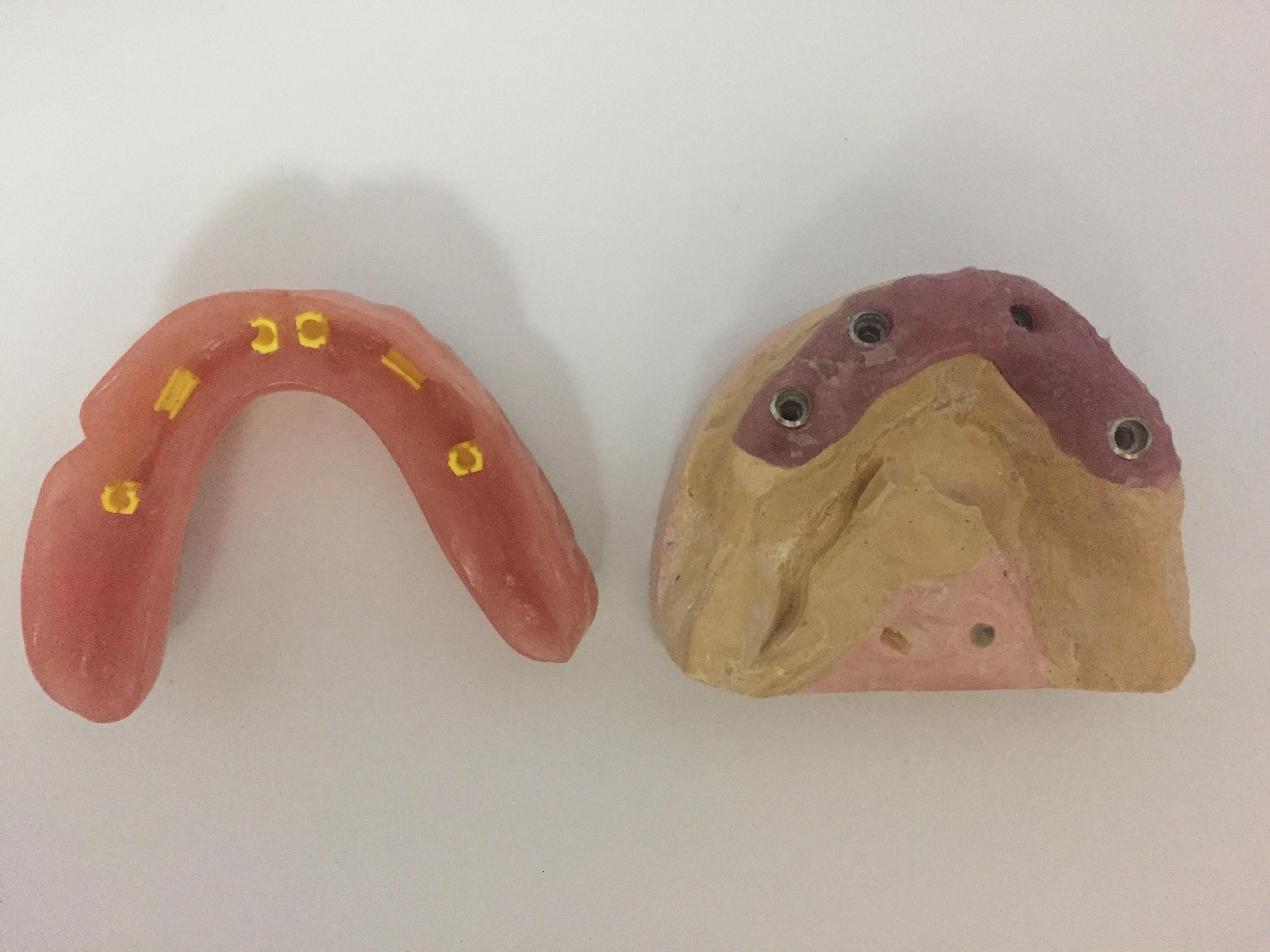Images Laboratorio de Prótesis Dental Gloria Camacho