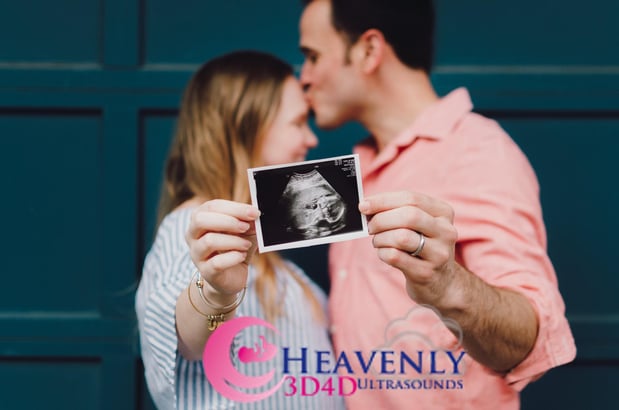 Images Heavenly 3D 4D Ultrasounds