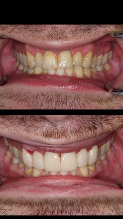 Images Sunbrite Dental