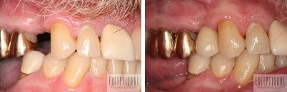 Images Exceptional Dentistry of the Tri-State Region