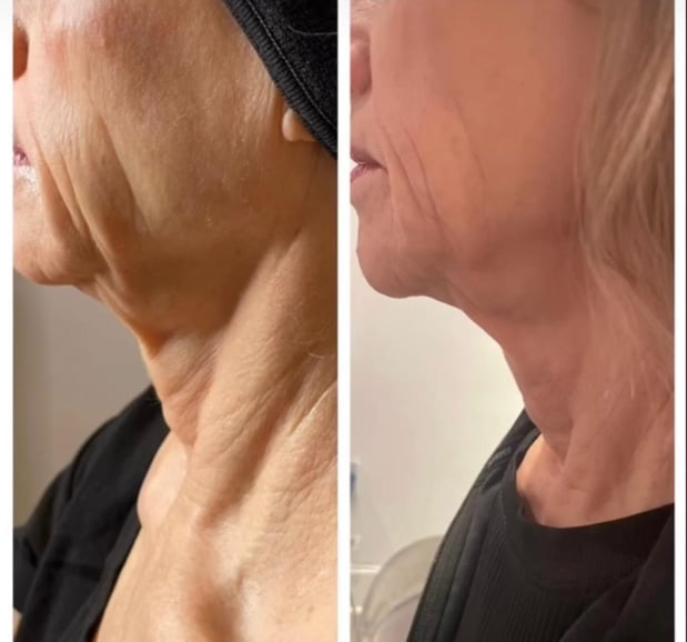 Images Body Lounge Park Cities - Whole Body Wellness & Medical Aesthetics, Dallas, TX