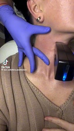 Images Beverly Wilshire Aesthetics Beverly Hills Medical Spa for Botox, Morpheus8, IPL, Lip Fillers