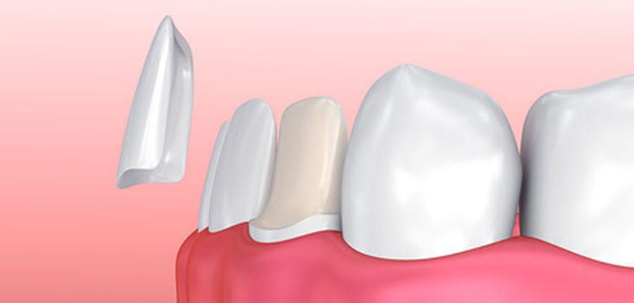 Kundenbild groß 7 Zahnarztpraxis Dr. Andrea Stein