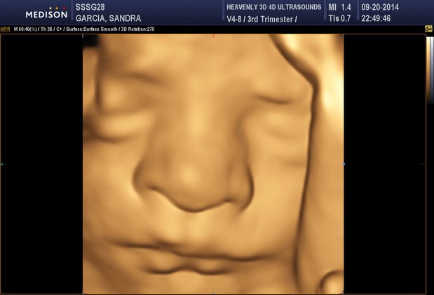 Images Heavenly 3D 4D Ultrasounds-Upland
