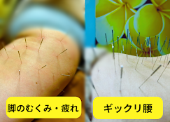Images 鍼処KAKUREGA