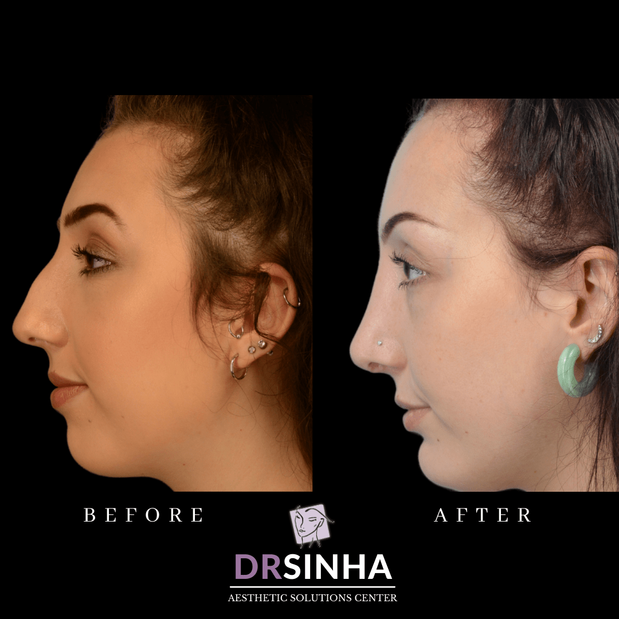 Images Pradeep K Sinha MD PhD FACS - Facial Aesthetic Surgery