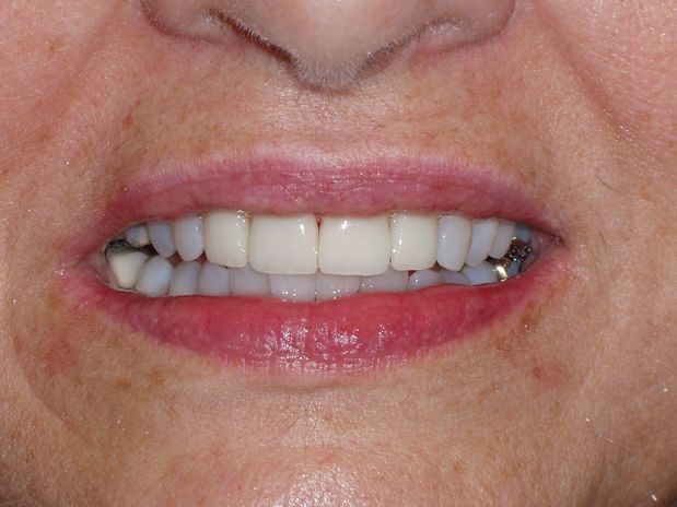 Images Aaron A. Leishman DMD, PA