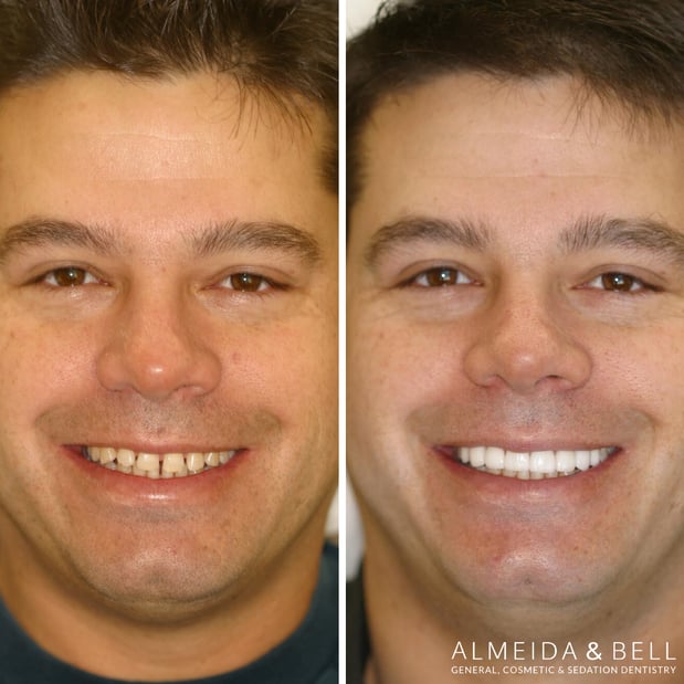 Images Almeida & Bell Dental Lone Tree - General, Cosmetic, and Implant Dentistry