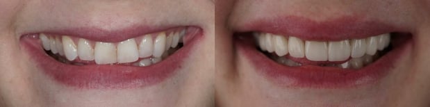 Images Watters Creek Dental