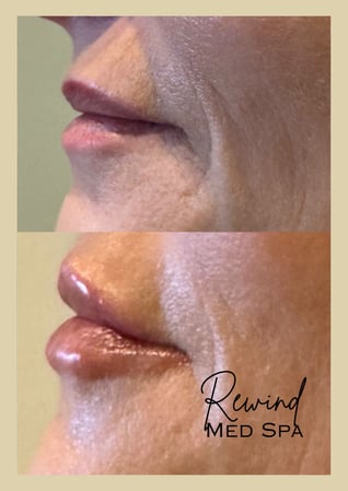 Images Rewind Med Spa