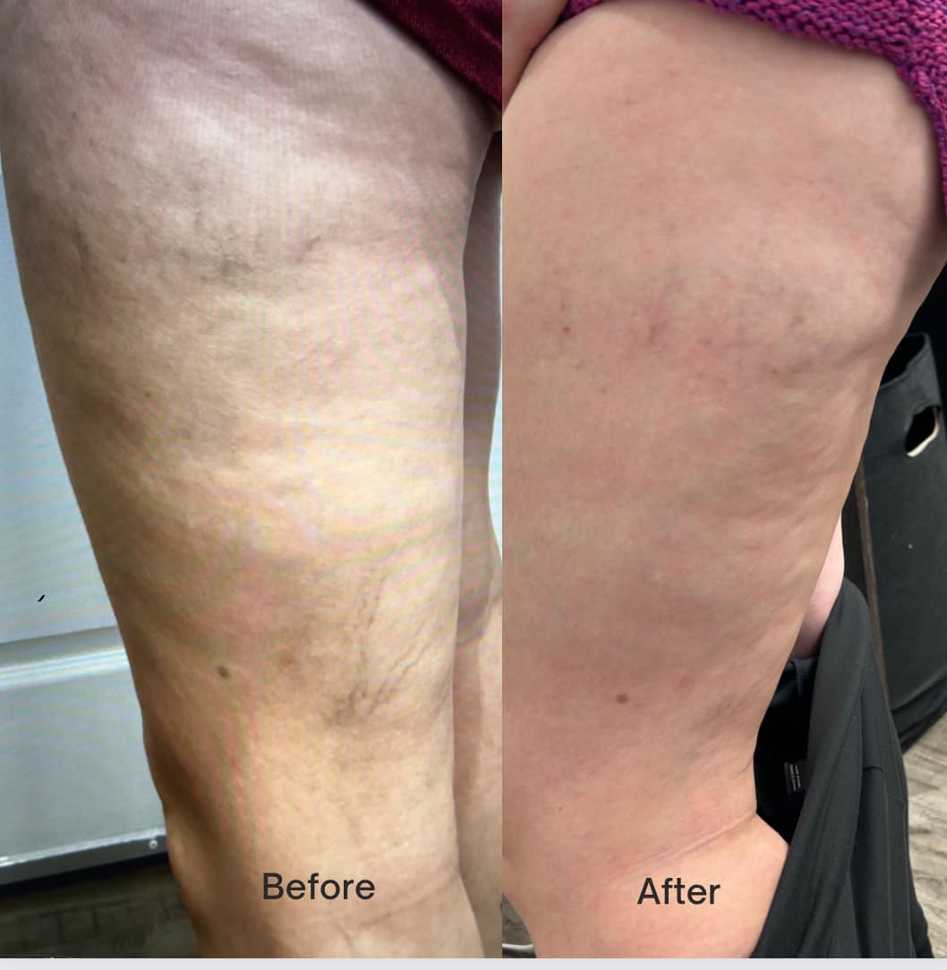 Images Onyx Esthétique - Soins esthétiques, Soins de la peau, Laser Cynosure Gatineau