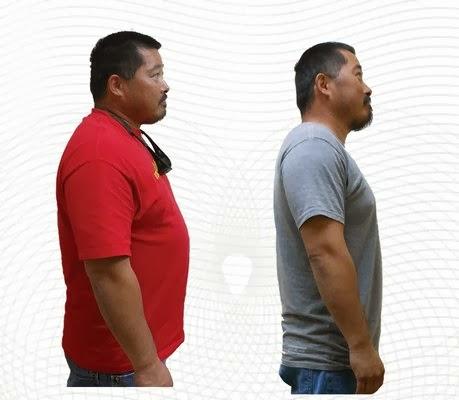 Images TrimBody M.D.