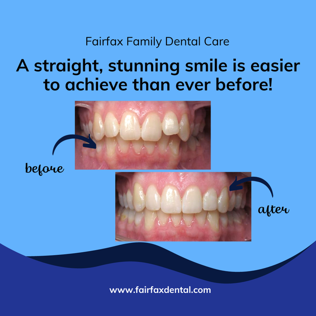 Images Fairfax Family Dental Care