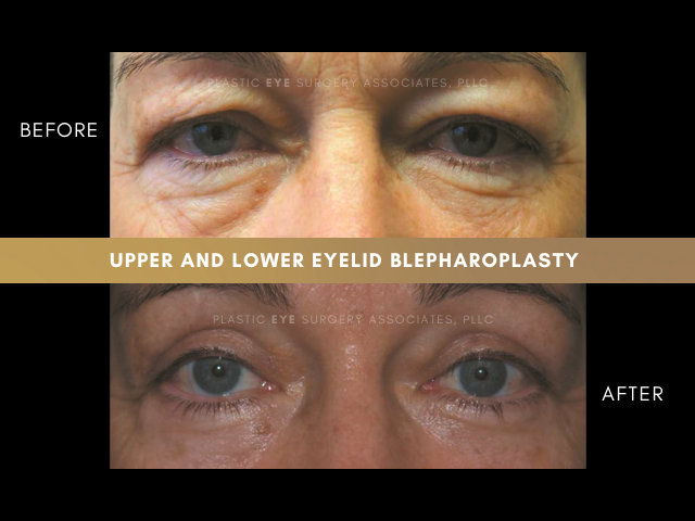 Images Plastic Eye Surgery Associates, PLLC