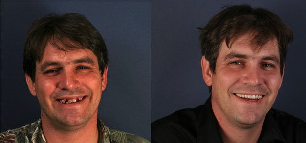 Images Schmitt Prosthodontics