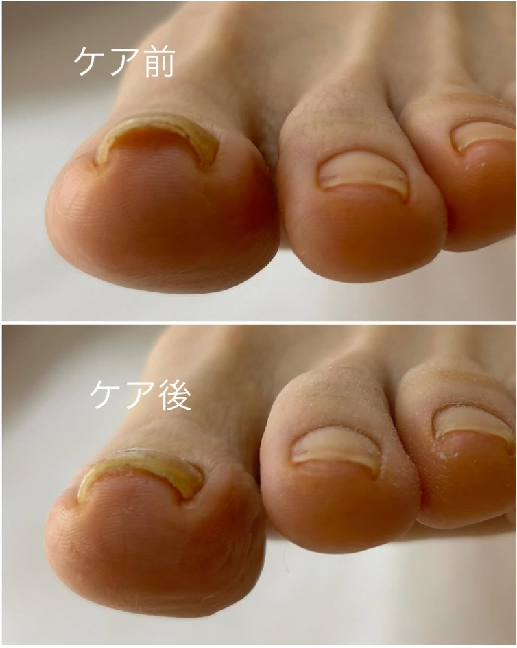 Images 足の専門店 おん