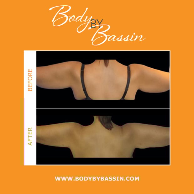 Images Body By Bassin Melbourne