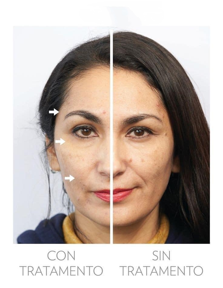 Images Fv Láser Nails Beauty